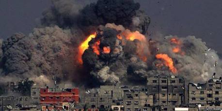 Massacre in Gaza: 1359 killed, 7677 injured by Israeli ‘Defence’ Forces since July 8.